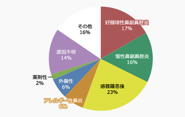 図１：嗅覚障害の原因疾患（慈恵医大嗅覚外来, 2014）