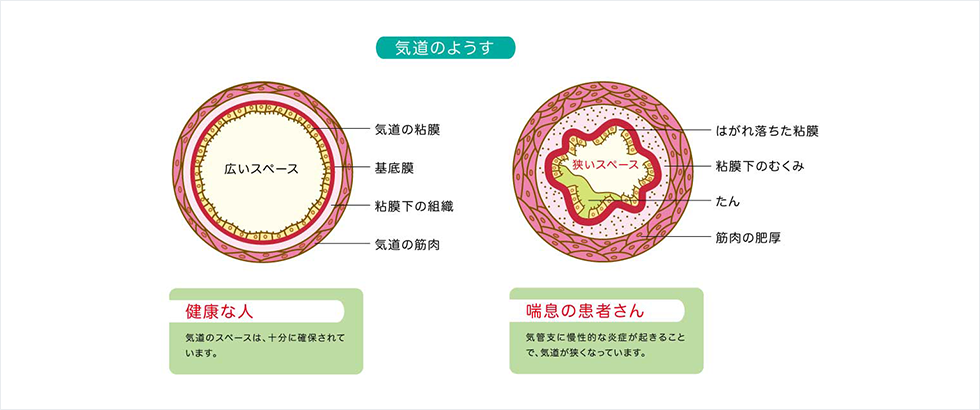 軌道の様子