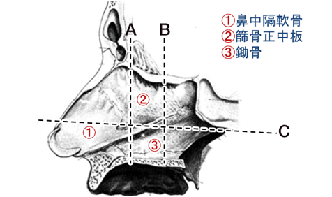 図1:鼻中隔のCTによる弯曲、粘膜肥厚の把握