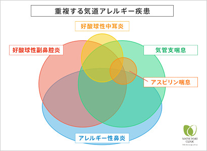 重複する気道アレルギー疾患
